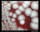bacillus anthracis